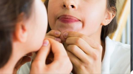 How to Pop a Pimple Without Destroying Your Skin